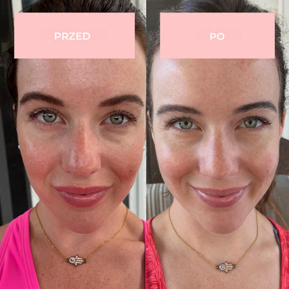 Monea LED Face Mask 7w1