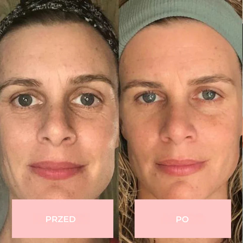 Monea LED Face Mask 7w1