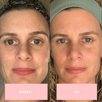 Monea LED Face Mask 7w1